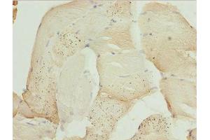 Immunohistochemistry of paraffin-embedded human skeletal muscle tissue using ABIN7175976 at dilution of 1:100 (ZBTB25 antibody  (AA 266-435))