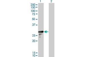 Western Blot analysis of DENR expression in transfected 293T cell line by DENR monoclonal antibody (M01), clone 1H3. (Density Regulated Protein antibody  (AA 1-81))