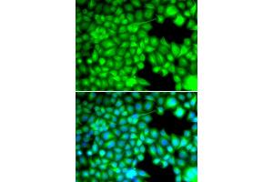 Immunofluorescence analysis of U2OS cells using FABP3 antibody (ABIN5973057). (FABP3 antibody)