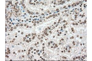 Image no. 11 for anti-TYRO3 Protein Tyrosine Kinase (TYRO3) antibody (ABIN1501605)