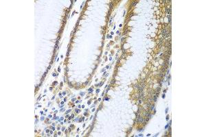 Immunohistochemistry of paraffin-embedded human stomach using FUT6 antibody at dilution of 1:100 (40x lens).