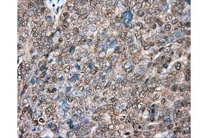 Immunohistochemical staining of paraffin-embedded colon tissue using anti-BSG mouse monoclonal antibody. (CD147 antibody)