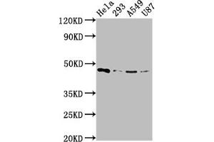 Western Blot Positive WB detected in: Hela whole cell lysate, 293 whole cell lysate, A549 whole cell lysate, U87 whole cell lysate All lanes: MAP2K1 antibody at 1:2000 Secondary Goat polyclonal to rabbit IgG at 1/50000 dilution Predicted band size: 44, 41 kDa Observed band size: 44 kDa (Recombinant MEK1 antibody)