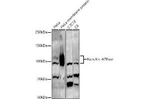 Western blot analysis of extracts of various cell lines, using Na+/K+-ATPase antibody (ABIN6133568, ABIN6137299, ABIN6137301 and ABIN6223860) at 1:500 dilution. (ATP1A1 antibody  (AA 1-100))