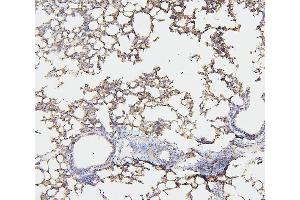IHC analysis of NF2 using anti-NF2 antibody (ABIN7600115).