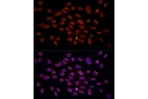 Immunofluorescence analysis of C6 cells using CRYGC antibody (ABIN6130868, ABIN6139079, ABIN6139080 and ABIN6224977) at dilution of 1:100 (40x lens). (CRYGC antibody  (AA 1-174))