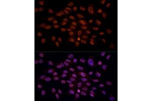 Immunofluorescence analysis of C6 cells using CRYGC antibody (ABIN6130868, ABIN6139079, ABIN6139080 and ABIN6224977) at dilution of 1:100 (40x lens). (CRYGC antibody  (AA 1-174))