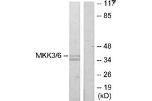 Western blot analysis of extracts from MDA-MB-435 cells, using MKK3 (Ab-189) Antibody. (MAP2K3 antibody  (AA 173-222))