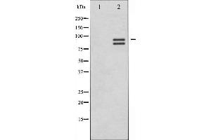 Western blot analysis of Glycogen Synthase expression in Serum treated HeLa whole cell lysates,The lane on the left is treated with the antigen-specific peptide. (Glycogen Synthase 1 antibody  (C-Term))