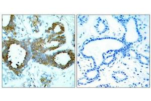 PAK1/2/3 anticorps  (pThr423)