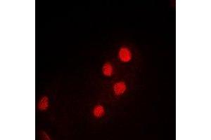 Immunofluorescent analysis of PDCD5 staining in MCF7 cells. (PDCD5 antibody)