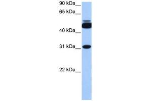 WB Suggested Anti-CYLC2 Antibody Titration: 0. (CYLC2 antibody  (C-Term))