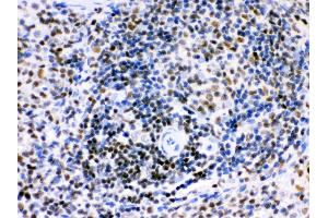 Anti- Ikaros Picoband antibody, IHC(P) IHC(P): Rat Spleen Tissue (IKZF1 antibody  (C-Term))