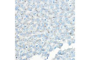 Immunohistochemistry (IHC) image for anti-Leucyl/cystinyl Aminopeptidase (LNPEP) (AA 1-110) antibody (ABIN6143284)