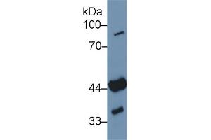 Detection of ADA in Human Jurkat cell lysate using Polyclonal Antibody to Adenosine Deaminase (ADA) (ADA antibody  (AA 11-280))