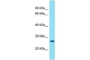 Western Blotting (WB) image for anti-Glutathione S-Transferase theta 2 (GSTT2) (Middle Region) antibody (ABIN2789659) (GSTT2 antibody  (Middle Region))