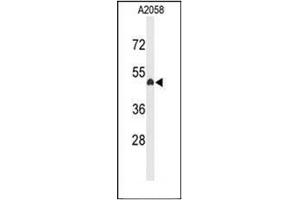 Western blot analysis of EYA4 Antibody (C-term) in A2058 cell line lysates (35ug/lane).