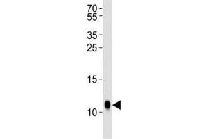 Western blot analysis of lysate from Drosophila tissue lysate using SUMO antibody diluted at 1:1000. (SUMO antibody  (AA 37-66))