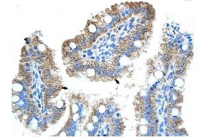 GTPBP9 antibody was used for immunohistochemistry at a concentration of 4-8 ug/ml to stain Epithelial cells of intestinal villus (arrows) in Human Intestine. (OLA1 antibody)