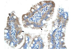 GTPBP9 antibody was used for immunohistochemistry at a concentration of 4-8 ug/ml to stain Epithelial cells of intestinal villus (arrows) in Human Intestine.