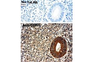 Immunohistochemistry (IHC) image for anti-Cadherin 1, Type 1, E-Cadherin (Epithelial) (CDH1) antibody (ABIN1440031) (E-cadherin antibody)