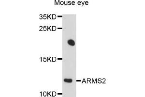 Western blot analysis of extracts of mouse eye, using ARMS2 antibody (ABIN4902948) at 1:1000 dilution. (ARMS2 antibody)