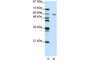 WB Suggested Anti-ZNF382 Antibody Titration:  1.