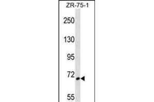 SH3BP1 Antibody (Center) (ABIN1538408 and ABIN2848605) western blot analysis in ZR-75-1 cell line lysates (35 μg/lane). (SH3BP1 antibody  (AA 419-446))