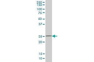 CIDEB monoclonal antibody (M01), clone 2A10 Western Blot analysis of CIDEB expression in HepG2 . (CIDEB antibody  (AA 3-110))