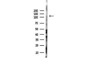 Western blot analysis of lysates from K562 cells(UV 30 min treatment), using KCNH5 Antibody at 1/1000 dilution.