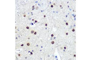 Immunohistochemistry (IHC) image for anti-Hes Family bHLH Transcription Factor 1 (HES1) antibody (ABIN7267624)