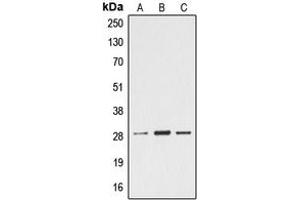 Western blot analysis of Ephrin A4 expression in Jurkat (A), mouse heart (B), rat heart (C) whole cell lysates. (EFNA4 antibody  (C-Term))