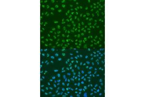 Immunofluorescence analysis of U2OS cells using ELAVL1 antibody (ABIN6292898) at dilution of 1:100.