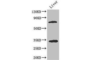 Western Blot Positive WB detected in: Mouse liver tissue All lanes: HDAC10 antibody at 3. (HDAC1 antibody  (AA 207-412))
