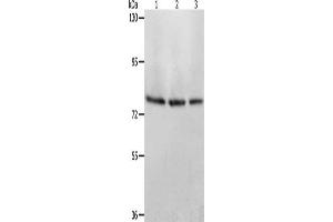 Gel: 8 % SDS-PAGE, Lysate: 40 μg, Lane 1-3: Mouse stomach tissue, Mouse liver tissue, Mouse kidney tissue, Primary antibody: ABIN7128170(ACOX1 Antibody) at dilution 1/350, Secondary antibody: Goat anti rabbit IgG at 1/8000 dilution, Exposure time: 1 minute (ACOX1 antibody)