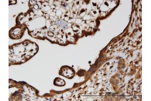 Immunoperoxidase of monoclonal antibody to HECTD2 on formalin-fixed paraffin-embedded human placenta. (HECTD2 antibody  (AA 331-440))