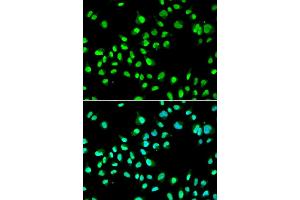 Immunofluorescence analysis of A549 cells using GTF2F2 antibody (ABIN5973440). (GTF2F2 antibody)