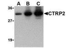 Western blot of recombinant CTRP2: (A) 5 ng, (B) 25 ng, and (C) 50 ng with AP30250PU-N CTRP2 at 1 ug/ml. (C1QTNF2 antibody)