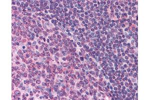 Anti-FPR1 antibody IHC of human tonsil. (FPR1 antibody  (Extracellular Domain))
