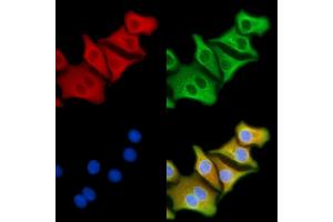 ABIN6257114 and ABIN6274151 staining Hela cells by IF/ICC. (CKM antibody  (N-Term))