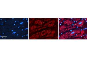 Rabbit Anti-PHB2 Antibody   Formalin Fixed Paraffin Embedded Tissue: Human heart Tissue Observed Staining: Cytoplasmic Primary Antibody Concentration: 1:100 Other Working Concentrations: 1:600 Secondary Antibody: Donkey anti-Rabbit-Cy3 Secondary Antibody Concentration: 1:200 Magnification: 20X Exposure Time: 0. (Prohibitin 2 antibody  (N-Term))