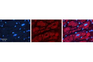 Rabbit Anti-PHB2 Antibody   Formalin Fixed Paraffin Embedded Tissue: Human heart Tissue Observed Staining: Cytoplasmic Primary Antibody Concentration: 1:100 Other Working Concentrations: 1:600 Secondary Antibody: Donkey anti-Rabbit-Cy3 Secondary Antibody Concentration: 1:200 Magnification: 20X Exposure Time: 0.