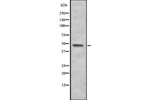 Western blot analysis of PANX1 using COLO205 whole cell lysates (PANX1 antibody  (Internal Region))