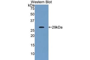 Western blot analysis of recombinant Human ANGPTL2. (ANGPTL2 antibody  (AA 267-493))