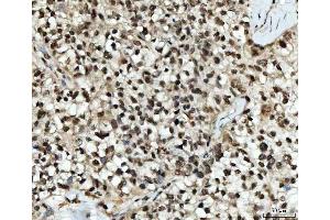 IHC analysis of UBC12/UBE2M using anti-UBC12/UBE2M antibody (ABIN7600885).