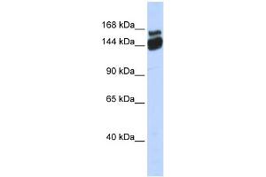 WB Suggested Anti-ZNF452 Antibody Titration:  0.