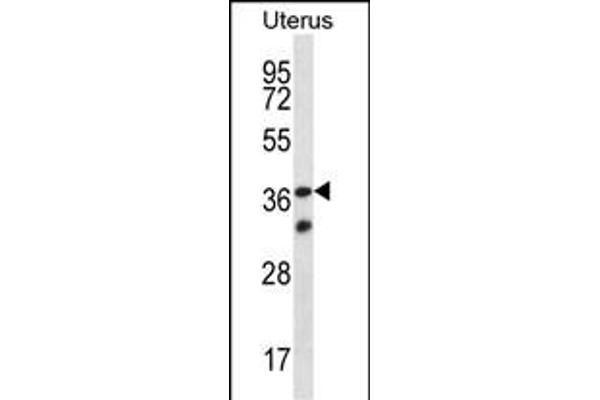 OR4X2 antibody  (C-Term)