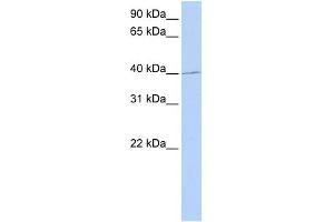WB Suggested Anti-PAX1 Antibody Titration: 0. (PAX1 antibody  (Middle Region))