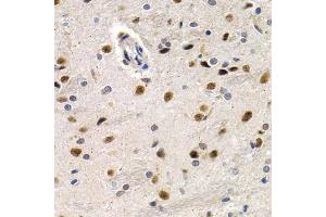 Immunohistochemistry of paraffin-embedded rat brain using ID3 antibody (ABIN6130481, ABIN6142140, ABIN6142141 and ABIN6221020) at dilution of 1:200 (40x lens). (ID3 antibody  (AA 1-119))