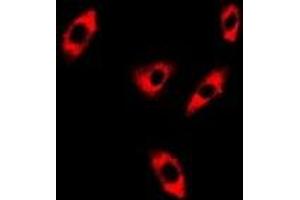 Immunofluorescent analysis of GTL3 staining in A549 cells. (C16orf80 antibody)